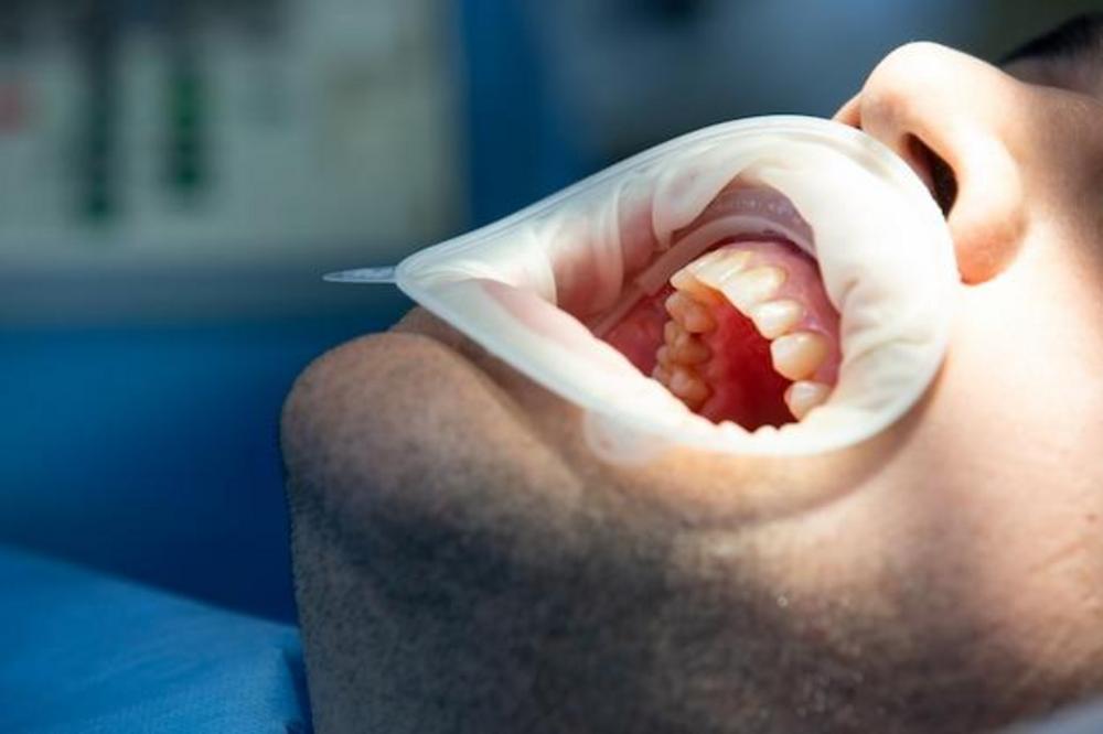 Reconstrução dentária