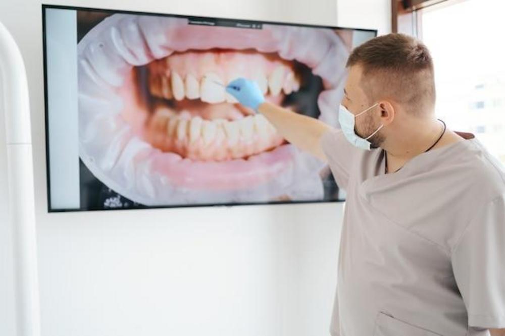 Scanner intraoral