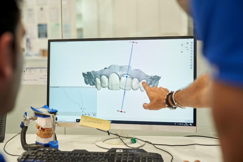 Escaneamento 3D Dental: A Revolução no Tratamento de A a Z